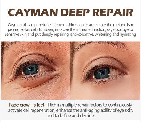 Magic Eye Cream – remove eye bags/dark circles/eye wrinkles
